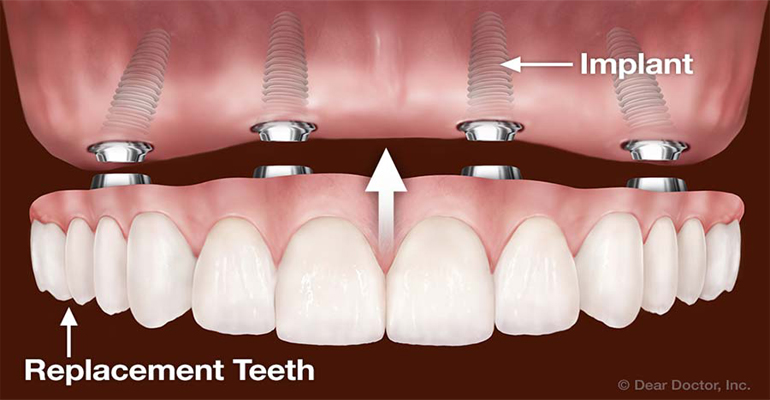 Dental Image
